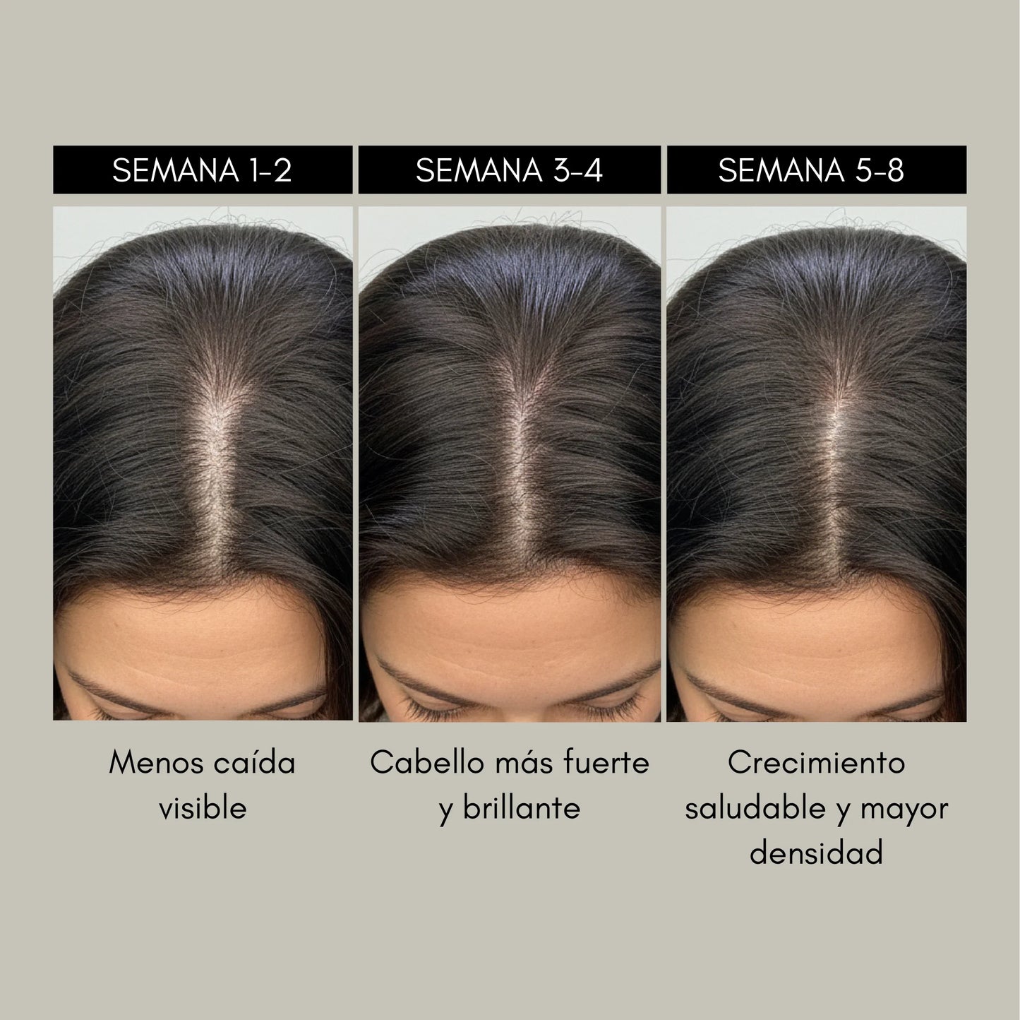 Cepillo Masajeador Para El Crecimiento Del Cabello